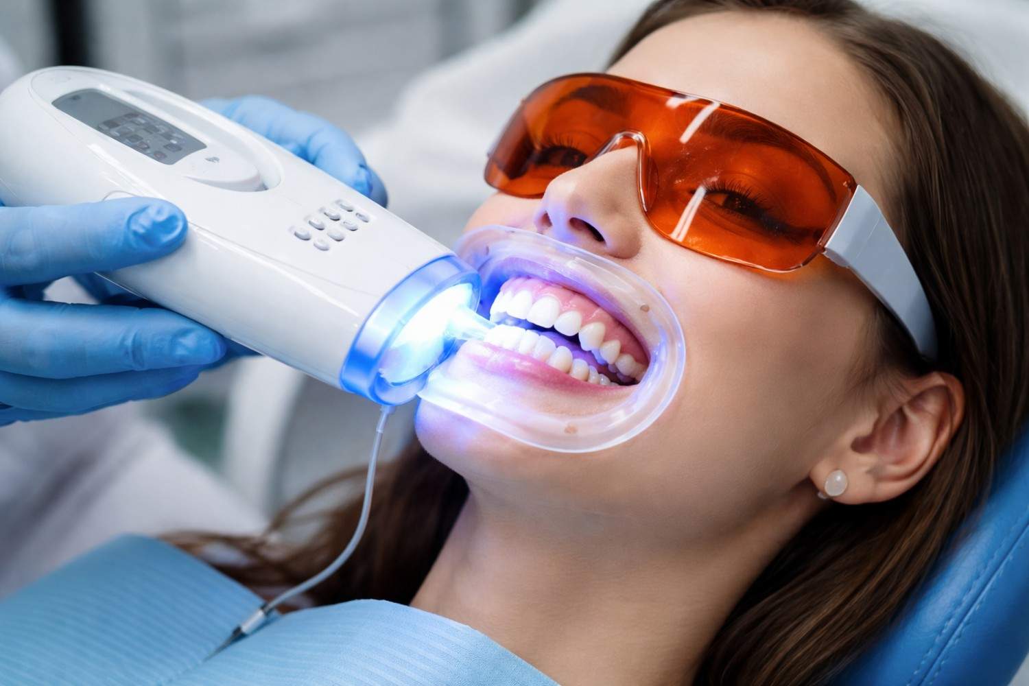Laser teeth whitening